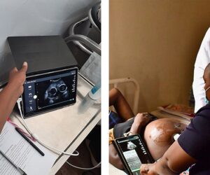 Pregnancy Tech And Convenience: Streamlining Maternal Health