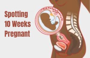 Read more about the article Spotting 10 Weeks Pregnant: Best to Know the Everything