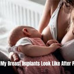 What Will My Breast Implants Look Like After Pregnancy: Best Tips