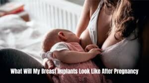 Read more about the article What Will My Breast Implants Look Like After Pregnancy: Best Tips