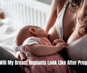 What Will My Breast Implants Look Like After Pregnancy: Best Tips