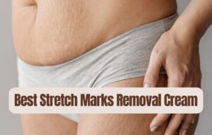 Read more about the article 13 Best Stretch Marks Removal Cream: Say Goodbye to Stretch!