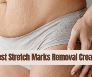 13 Best Stretch Marks Removal Cream: Say Goodbye to Stretch!