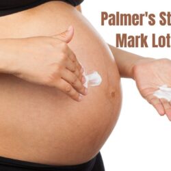 20 Palmer’s Stretch Mark Lotion: Solution for Flawless Skin