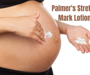 20 Palmer’s Stretch Mark Lotion: Solution for Flawless Skin