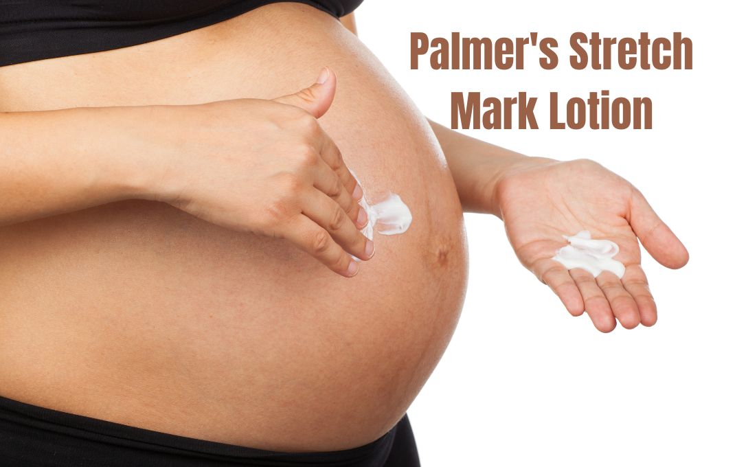 You are currently viewing 20 Palmer’s Stretch Mark Lotion: Solution for Flawless Skin