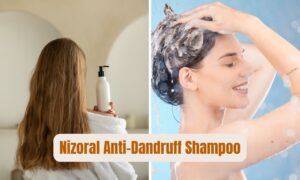 Read more about the article Nizoral Anti-Dandruff Shampoo: Best Say Goodbye to Dandruff